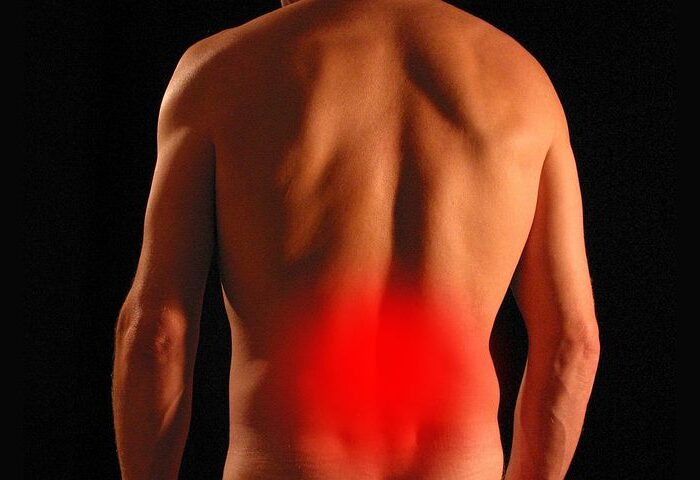 Physiotherapie